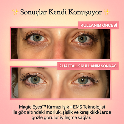 Magic Eyes Göz Altı Morluğu ve Kırışıklık Giderici